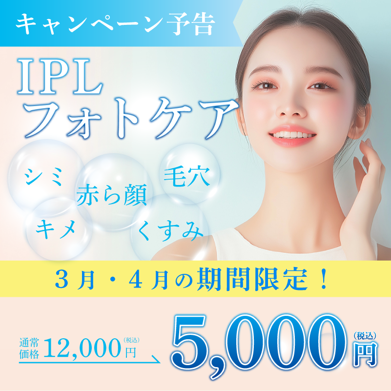 3月・4月キャンペーン予告